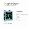 24 Hours Trend Palm Mini End Tidal CO2 Digital Monitor EtCO2/CO2 Monitor view 2