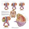 Posterazzi Medical chart showing the signs and symptoms of kidney cancer Poster Print, (25 x 32) view 1