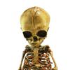 Asylum Zone Vintage in-Utero Fetus Skeleton view 4