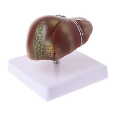 MOMOJIA Human Liver Pathological Anatomical Model Anatomy School Teaching Display Tool Lab Equipment
