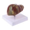MOMOJIA Human Liver Pathological Anatomical Model Anatomy School Teaching Display Tool Lab Equipment view 1