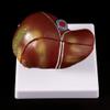 MOMOJIA Human Liver Pathological Anatomical Model Anatomy School Teaching Display Tool Lab Equipment view 4