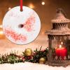 Baking Dessert Food Christmas Tree Ornaments Chocolate Donuts Christmas Keepsake Round Ceramic Xmas Ornaments Dessert Sweet Frosted Donut Christmas Decor to Kids Child view 3