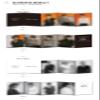 TAN - 1st Anniversary Special Album ESSEGE META Album (2 Versions Set) view 4