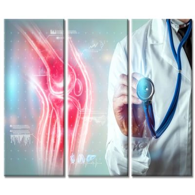 X-Ray Image Trauma Rheumatologist Consultation Skeletal Posters Wall Pictures 3 Panels Framed Wall Art Clinical Laboratory Wall Art Giclee Wooden Framed Gallery-Wrapped Ready to Hang (42"Wx28"H)