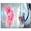 X-Ray Image Trauma Rheumatologist Consultation Skeletal Posters Wall Pictures 3 Panels Framed Wall Art Clinical Laboratory Wall Art Giclee Wooden Framed Gallery-Wrapped Ready to Hang (42"Wx28"H) view 1