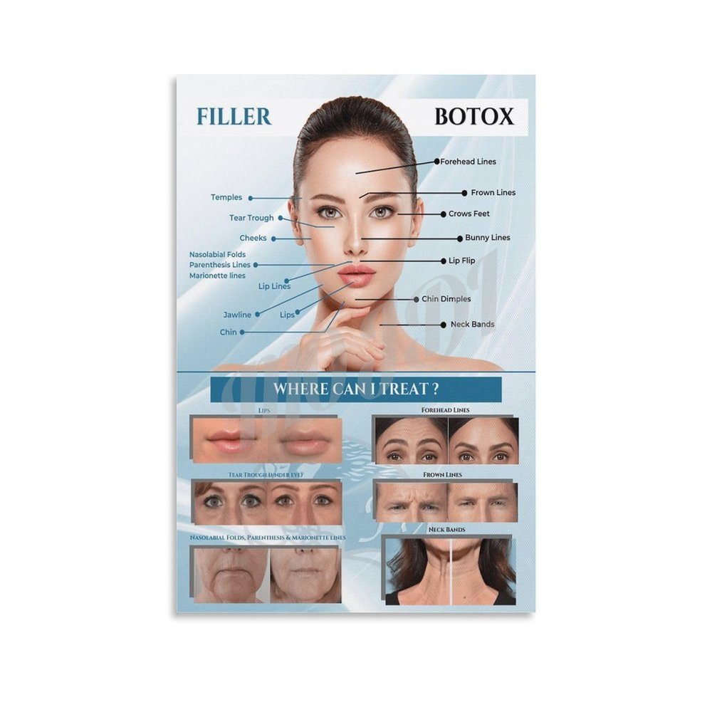 TSFTEC Botox Filler Injection Poster Botox Poster for Reducing Wrinkles And Fine Lines (2) Canvas Painting Wall Art Poster for Bedroom Living Room Decor 12x18inch(30x45cm) Unframe-style
