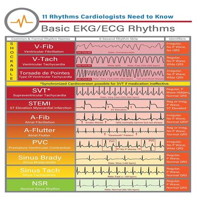 Cardiology Knowledge Posters Basic Ekg/Ecg Rhythms Metal Signs School Room Decor Home Club Wall Decor Vintage Plaque 12x16 inchses